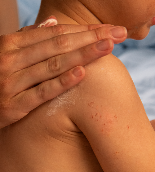 best-cream-for-eczema - Mustela Australia - 1