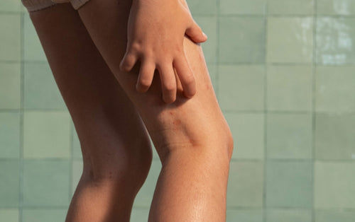 child-itching-his-leg-with-eczema - Mustela Australia - 1