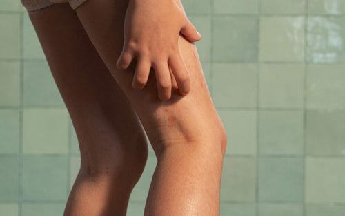 child-itching-his-leg-with-eczema - Mustela Australia - 1