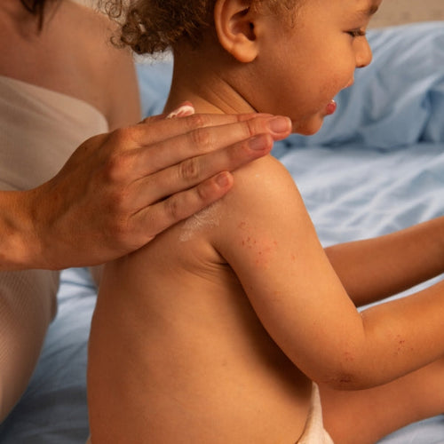 Mum applying cream on baby's back - Mustela Australia - 1
