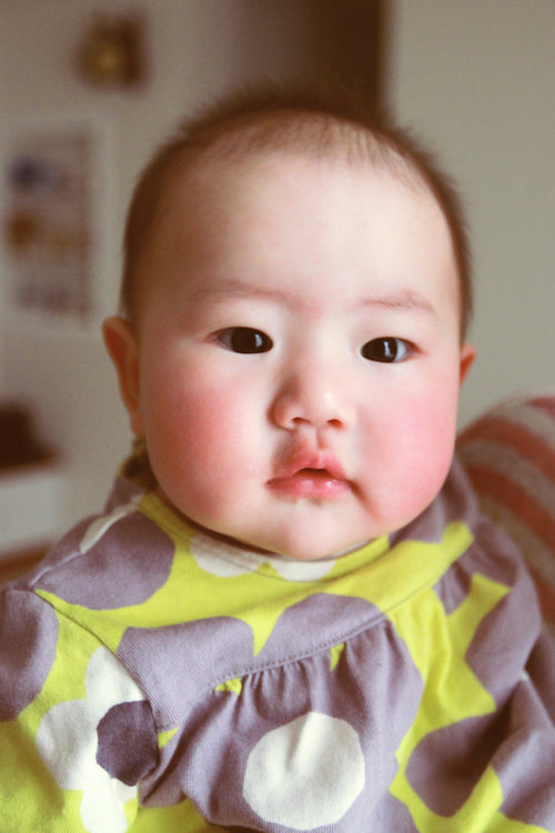 baby-with-red-cheeks - Mustela Australia - 1