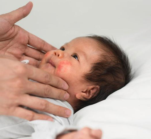 Parent gently smoothing emollient cream onto a baby's face - Mustela Australia - 1