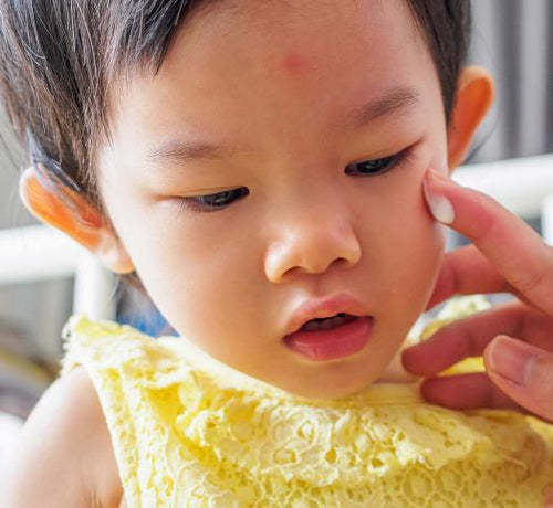 Parent applying moisturiser to a toddler's eczema-prone face - Mustela Australia - 1