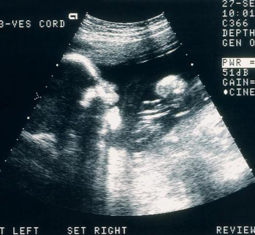 Tips for a tobacco free pregnancy - Mustela Australia - 1