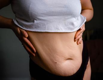 woman-postpartum-belly